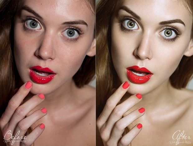 Cor da pele vermelhidão